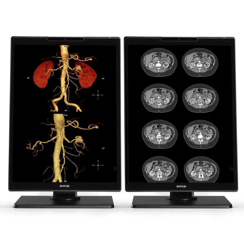 Breast Imaging and Mammography