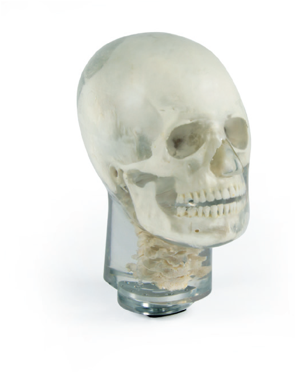 X-ray phantom head