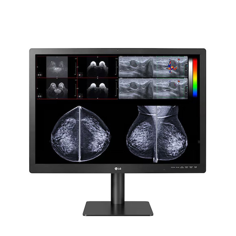 LG 31” IPS 12MP Diagnostic Monitor for Mammography (31HN713D-B)